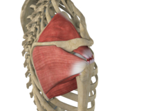 Massive Retracted Rotator Cuff Tear