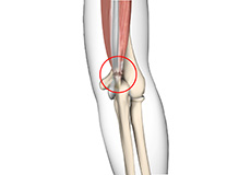 Triceps Injuries